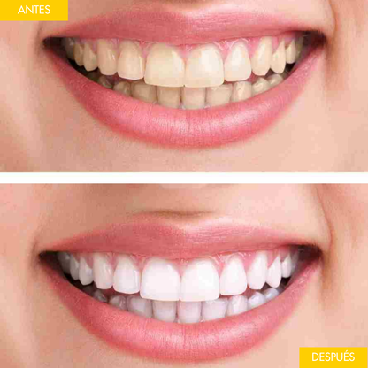 Cepillo de Dientes Eléctrico WhiteSmile X3® + Blanqueador Dental GRATIS